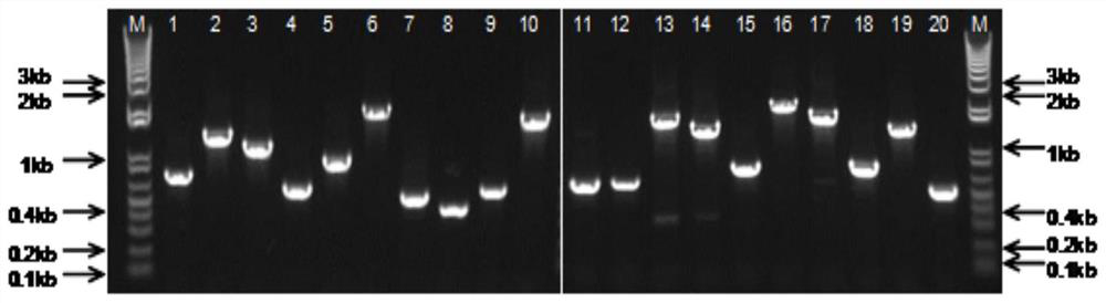 一種棘阿米巴特異性抗原肽、多克隆抗體及其用途